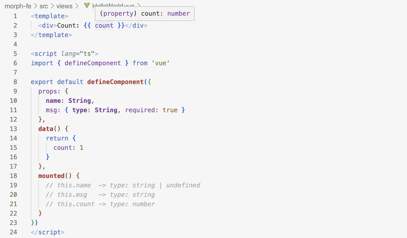 Vue component in VS Code